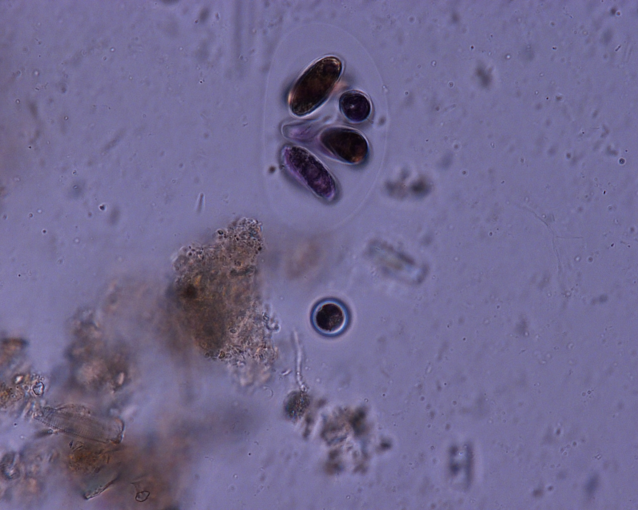 Dictyocha speculum